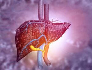 Liver Cancer Surgeon in Patel Nagar